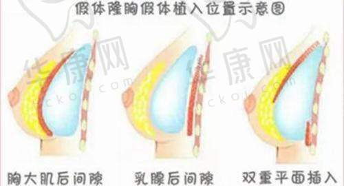 柴庆勋医生预约方式