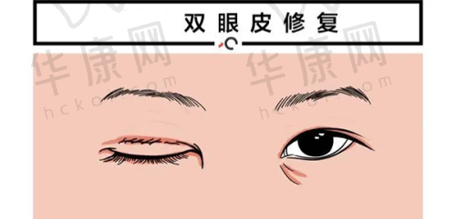 对邓红英医生与乐山达芬奇的感激