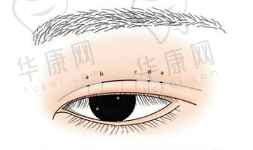 术后修复：成效显著超乎想象