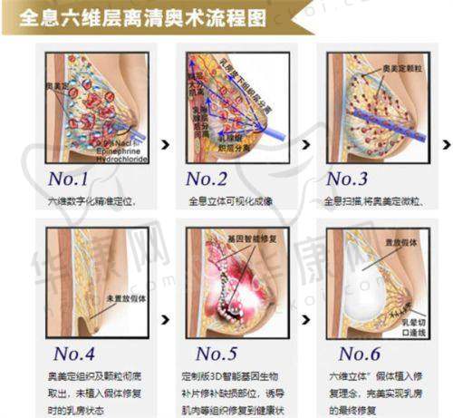沈阳杏林整形外科医院轻医美价格划算吗?