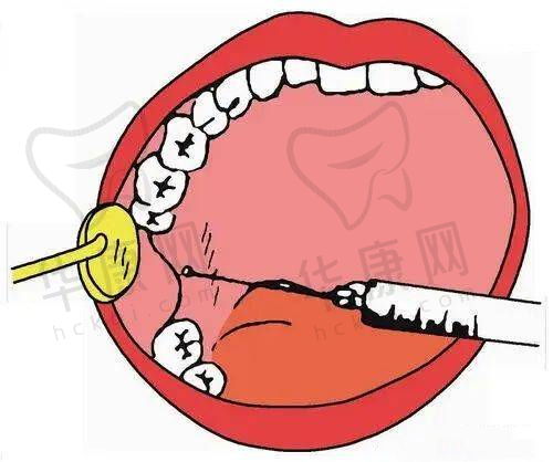 邵菊丽动感丰胸项目价格详情