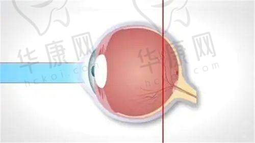福州东南眼科医院网上预约挂号有哪些注意事项？