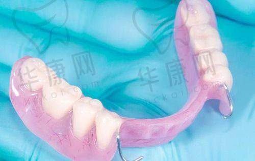 简阳圣洁口腔半口活动义齿仅1800元起，超高性价比的口腔修复之选！