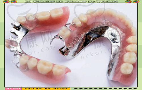 重庆种博士口腔全口活动假牙的服务特色