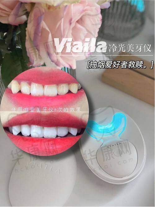 海宁圣麦口腔冷光美白的技术优势