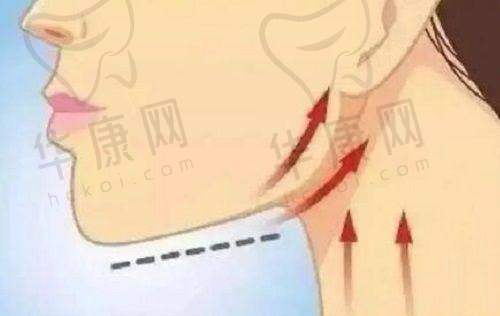 张少飞医生擅长项目