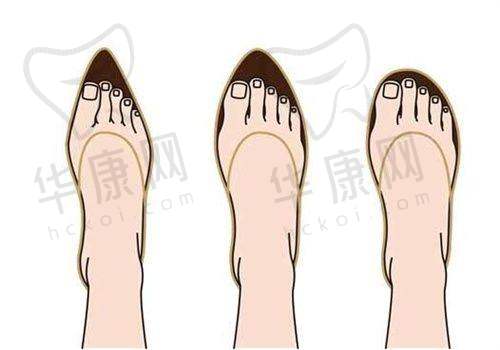 上海虹桥医院疤痕科单兴柱凹陷疤痕之治疗过程体验