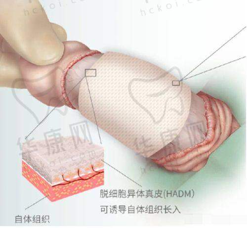 南阳卧龙天后医疗美容——术后修复