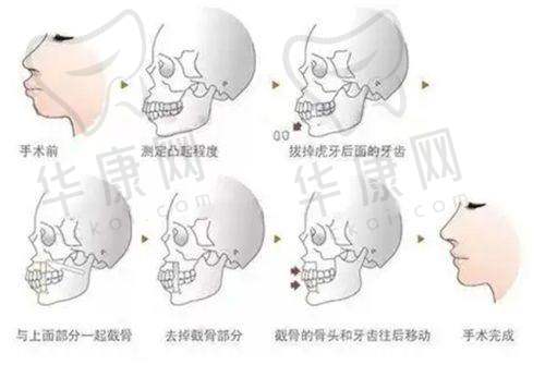 华中科技大学同济医学校附属协和医院整形科科室规模和项目有哪些亮点？