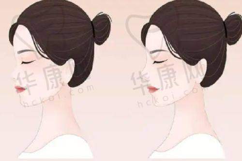 广州华美整形医院医生水平如何？雄厚团队揭秘