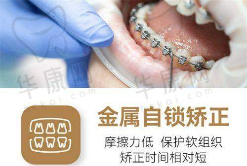 东莞南城贝壳美牙口腔在正雅悦享隐形矫正方面的特色优势