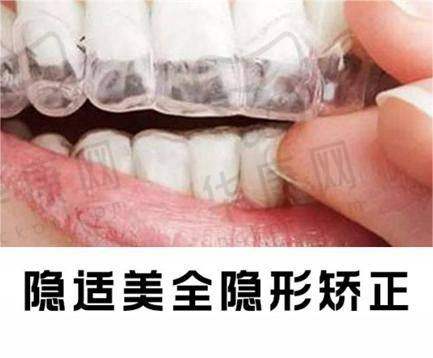 选择东莞南城贝壳美牙口腔李裕锋正雅悦享隐形矫正的理由