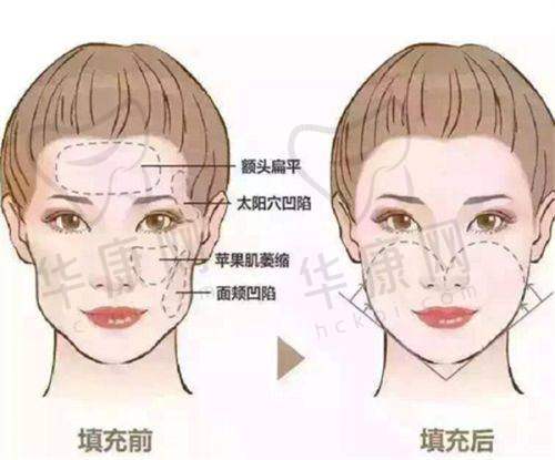 北京冰新丽格价格收费正规