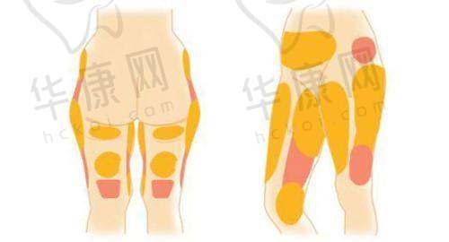 三、珠海如花医疗美容门诊部医生介绍: