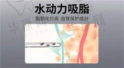 泉州丰泽脂管加医疗美容王健脂肪填充之术后护理
