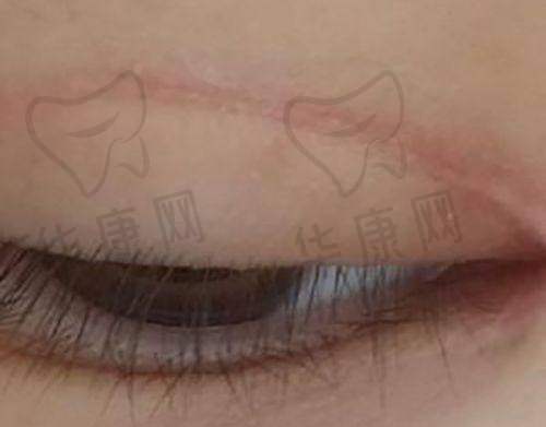 重庆十大植发正规医院排行榜揭晓，各院特色、价格及选择攻略大公开