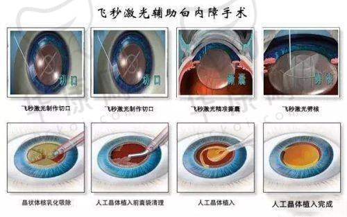 南阳卧龙天后隆鼻——手术进行时