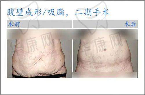 北京黄寺整形医院服务与价格