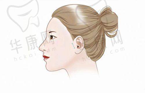 长沙雅美医疗美容医院胡艺觉医生预约方式