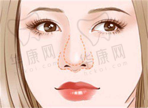 合肥华美整形医院去眼袋价格与实例