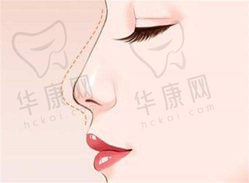 彦培庆医生:肌肤年轻化的骨干医生