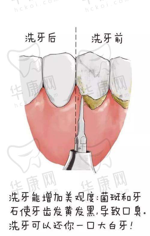 大连米嘉口腔龈下刮治的医生团队优势