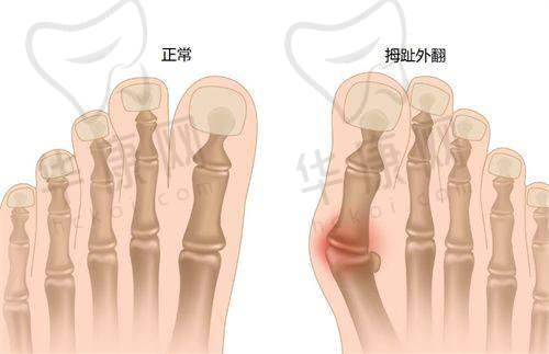北京润颜医疗美容彦培庆痤疮修复之专精面诊