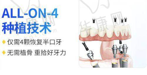 重庆中三口腔全口仕诺康种植牙仅40000元起，价格公道技术成熟！