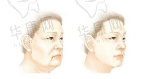 安徽医 科 大学第一附属医院植发科挂号在哪?