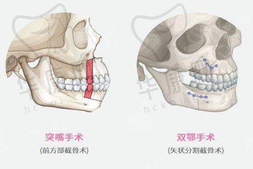 深圳景田医院在面部除皱术方面的特色优势