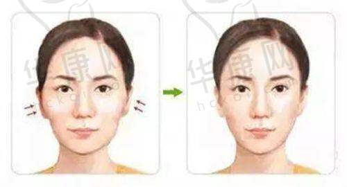 五、德州天宏医疗美容门诊部怎么预约: