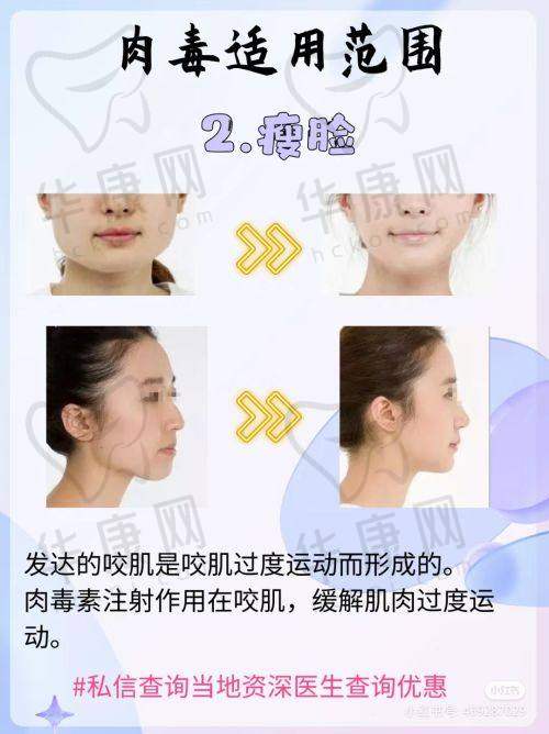 上海伊莱美医疗美容医院邱文苑鼻部整形术后修复