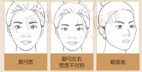 深圳今喜医疗美容曹孟君拉皮之手术过程