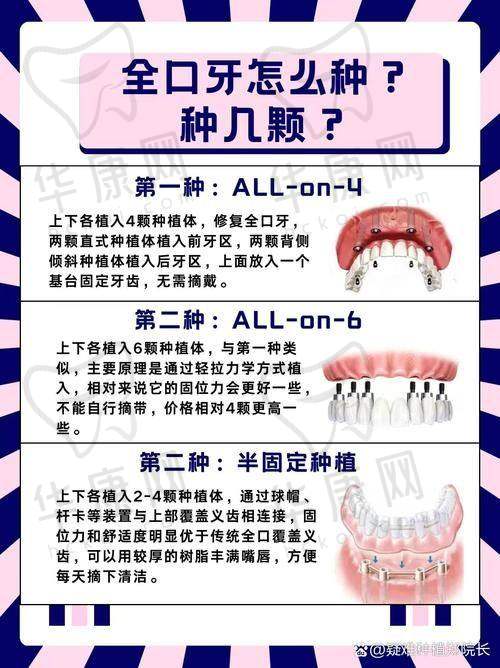 成都医大口腔医院全口种植牙之方案制定