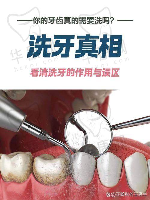 肥城可恩口腔医院喷砂洁牙的口碑与实例