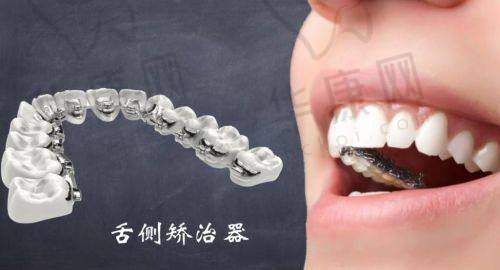 汕头牙加美口腔医院医生在舌侧矫正方面的实力