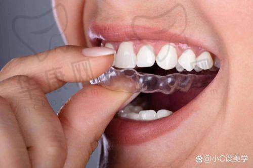 汕头牙加美口腔医院舌侧矫正的服务特色