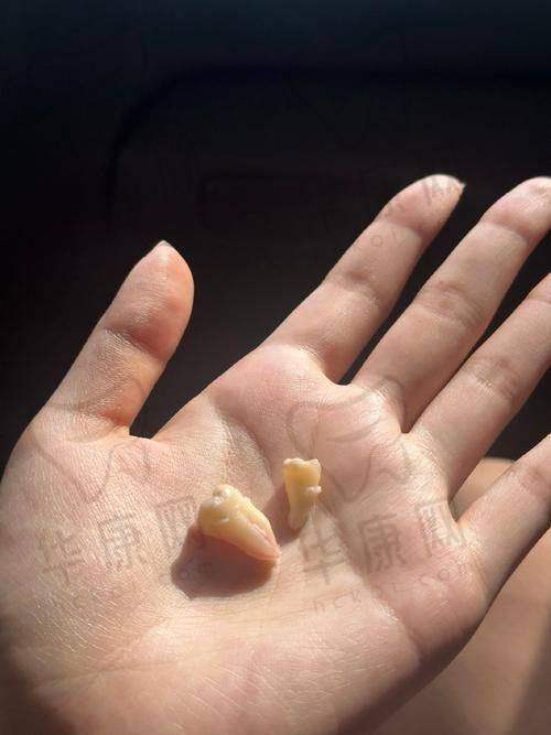 济南明湖可恩口腔医院医生在该项目的优势体现