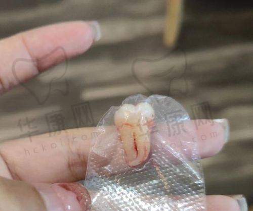 济南明湖可恩口腔医院在该项目的特色优势