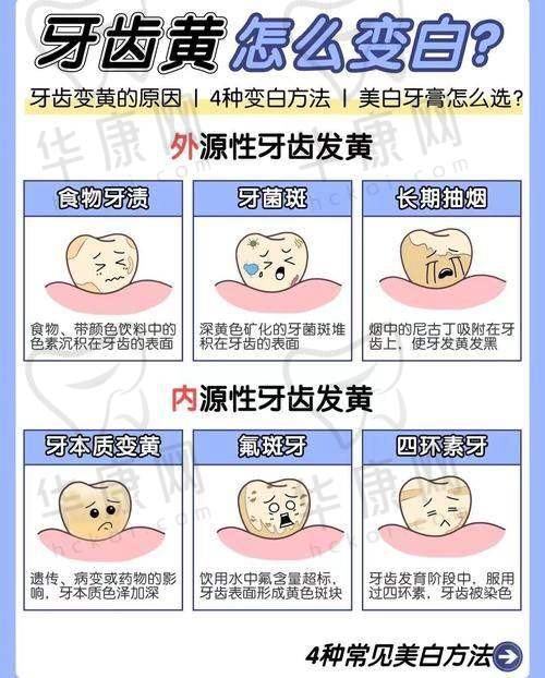 广州德仁口腔牙齿贴面的初次就诊