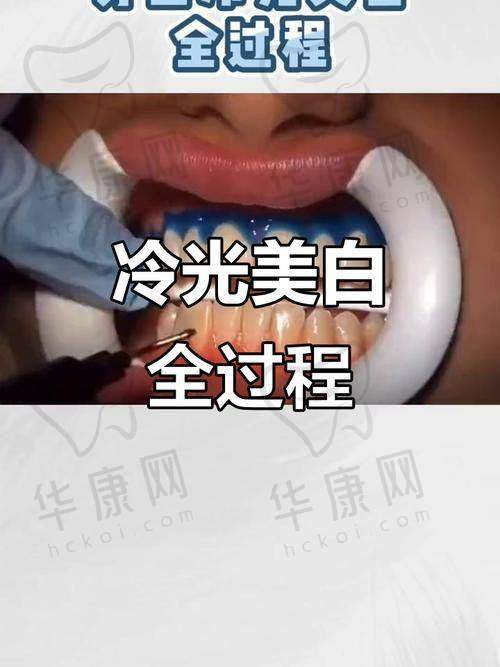 淮安诺贝尔口腔冷光美白医生专精优势