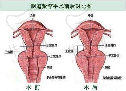 叶明龙医生在鼻综合项目的专精能力