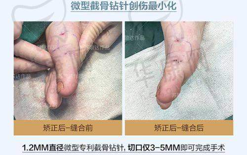中山美南华美容医院的技术升级