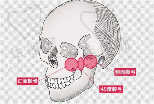 太原军大白继平双眼皮修复技术：精细专精显实力
