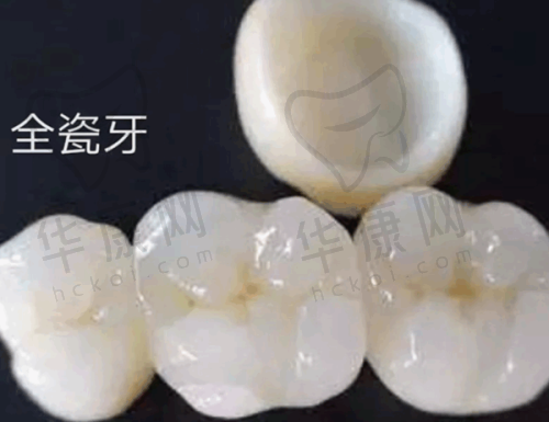 乌鲁木齐美奥口腔泽康全瓷冠3300元起，品质优且品牌多性价比超高！