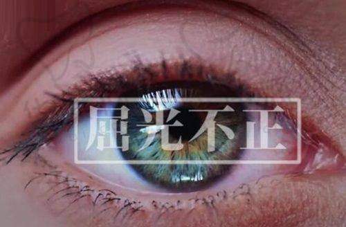 昆明眼科医院做圆锥角膜交联手术人多，源于医生优费用低疗效好助患者康复