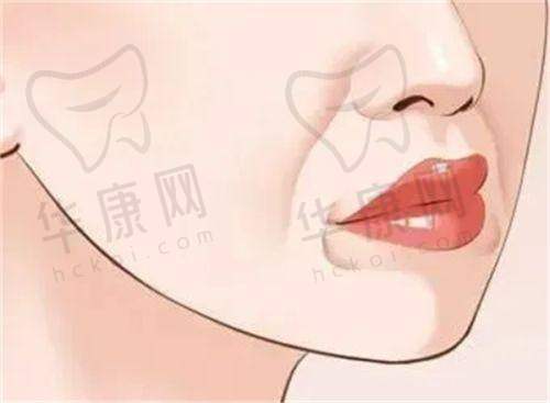 东莞东城爱思特医疗美容魏鑫铭脂肪填充之总结感受