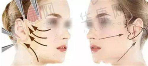 兰州臻韩美学整形是正规的吗？资质、技术、服务全优，答案是肯定的！