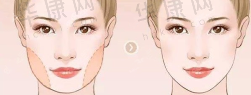 三、西安美合医疗美容门诊部医生介绍: