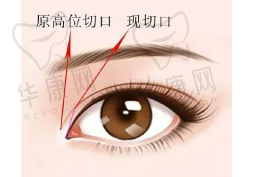哈尔滨韩美整形的特色项目及技术优势